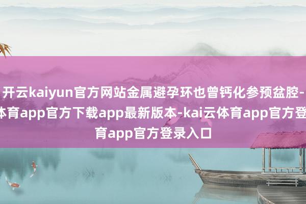 开云kaiyun官方网站金属避孕环也曾钙化参预盆腔-kai云体育app官方下载app最新版本-kai云体育app官方登录入口